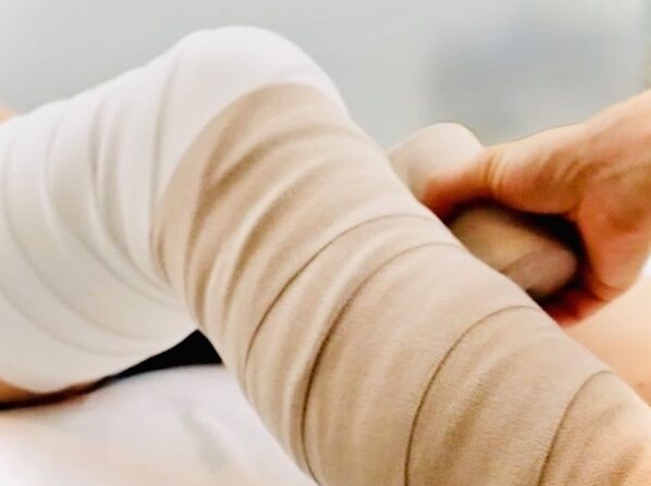 Short stretch bandaging as a part of combined decongestive therapy (CDT) for treatment of lymphedema.